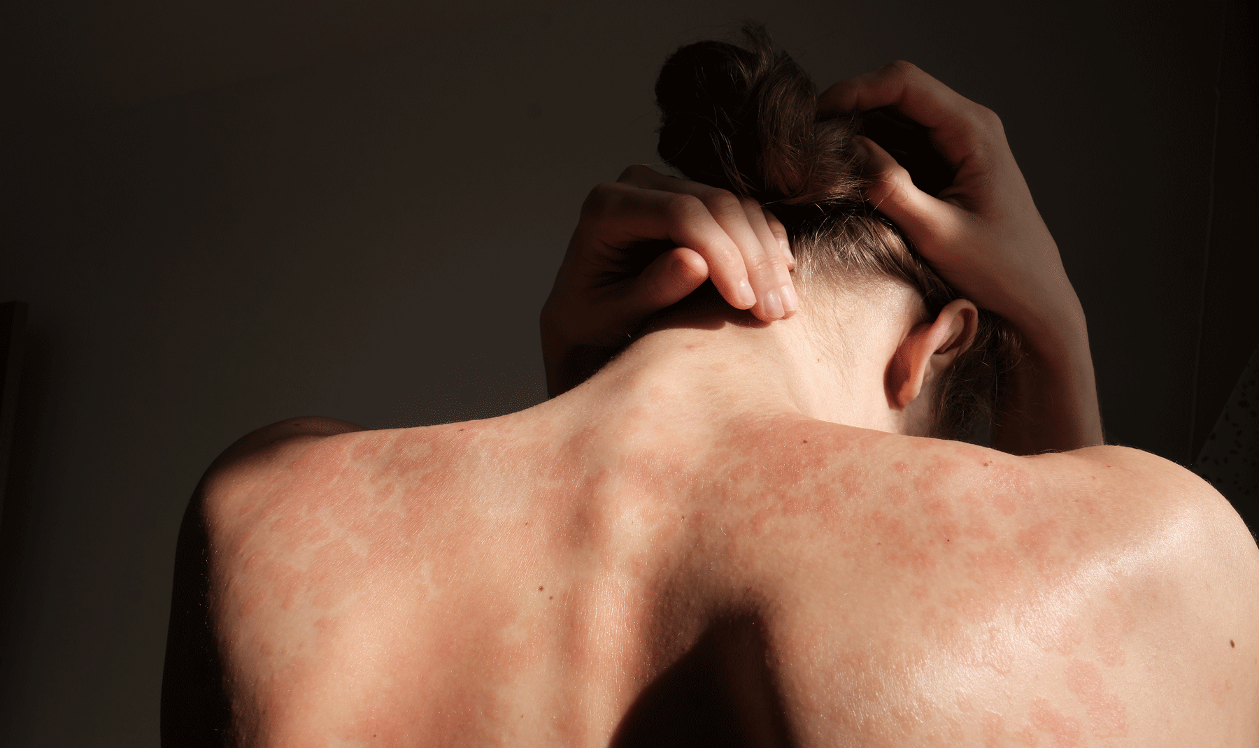 Skin Disorders - Cathedral Dermatology