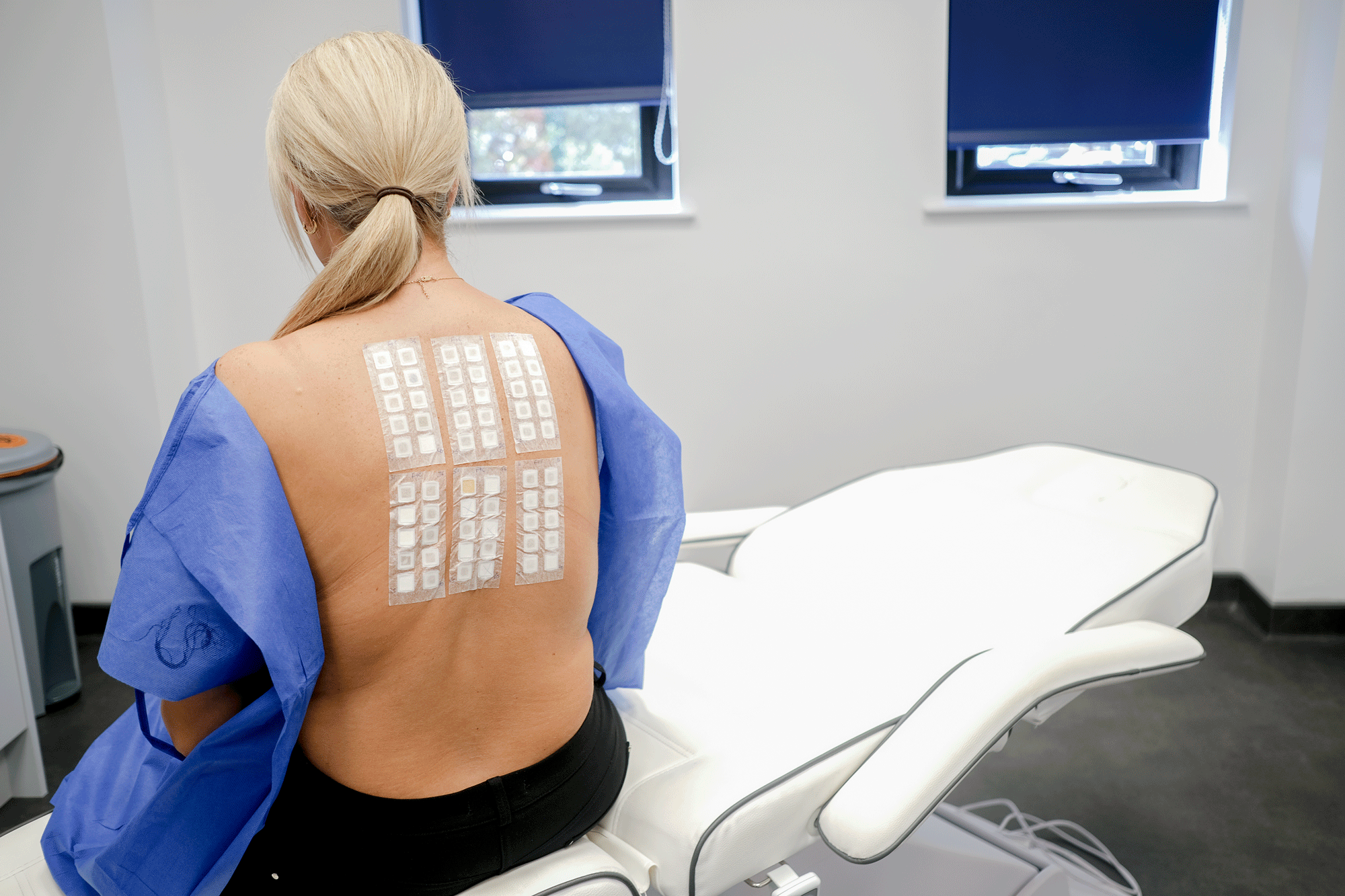 Patch Day Testing Patch Testing - Cathedral Dermatology