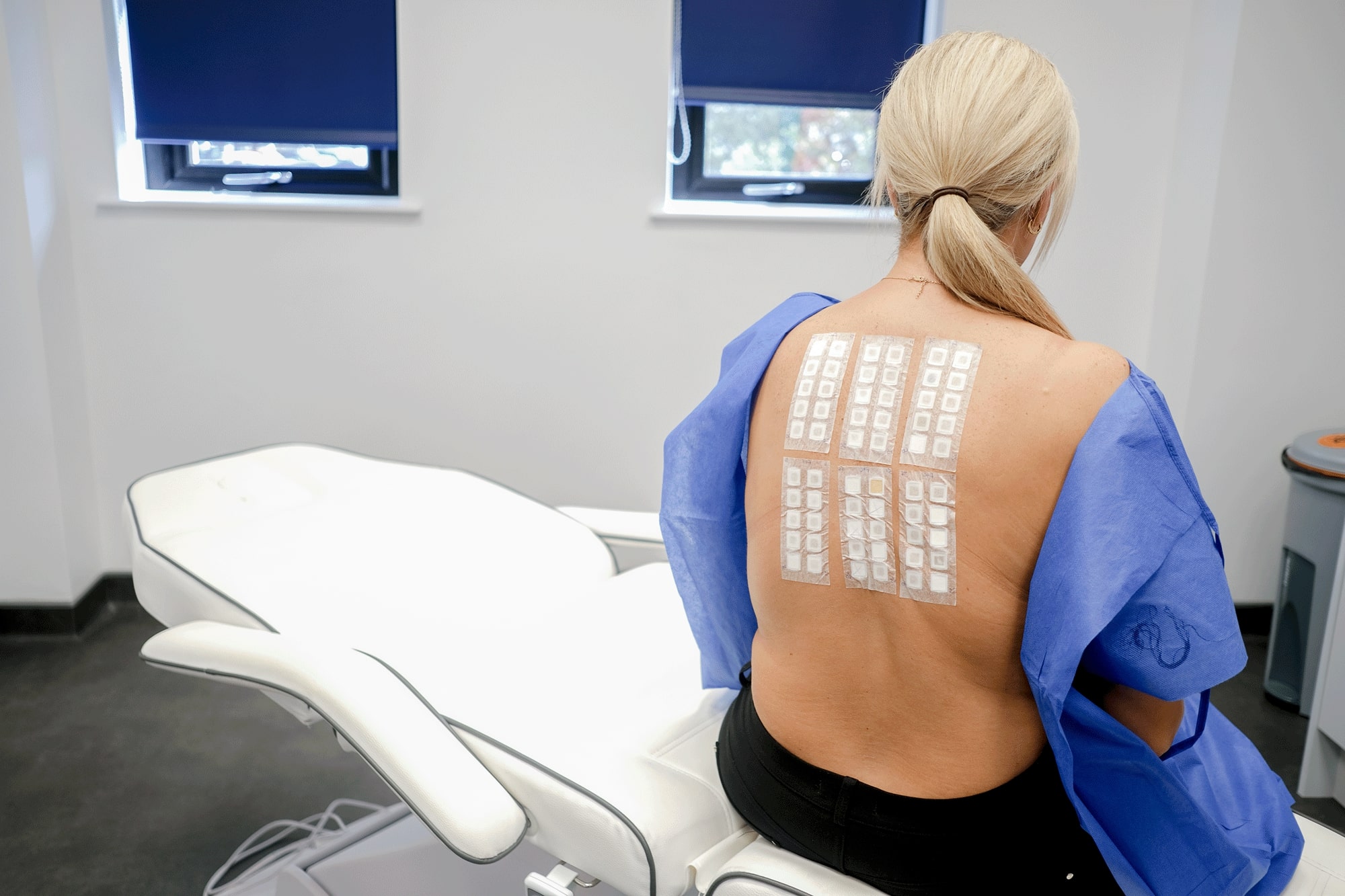 Patch Testing - Cathedral Dermatology