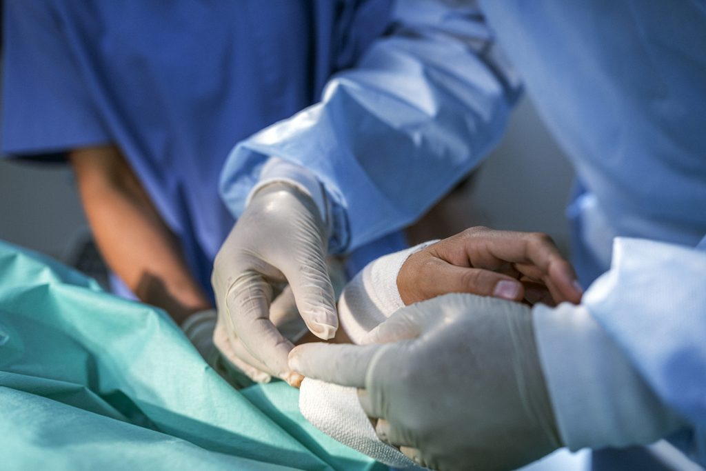 Hand Surgery Belfast